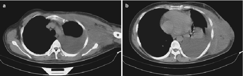 Fig. 17.109