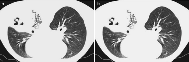 Fig. 17.68