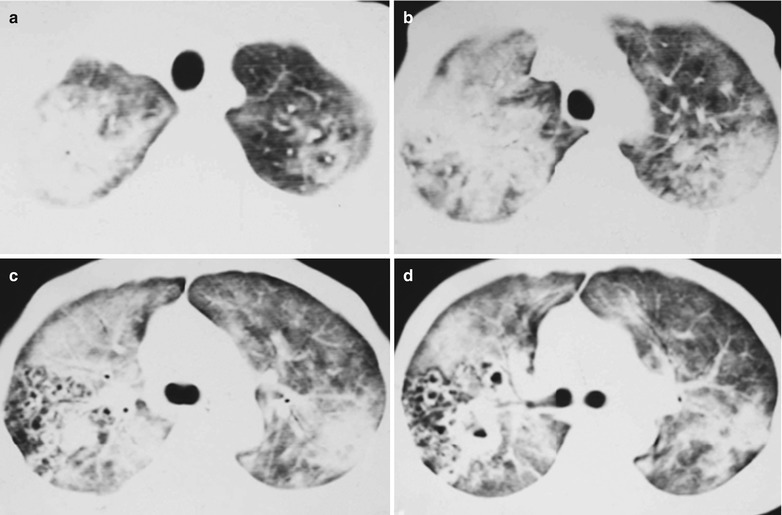 Fig. 17.93