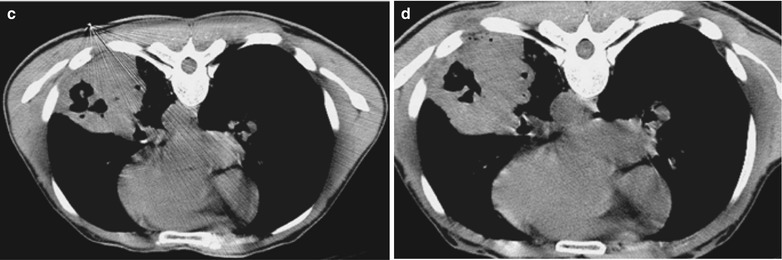 Fig. 17.68