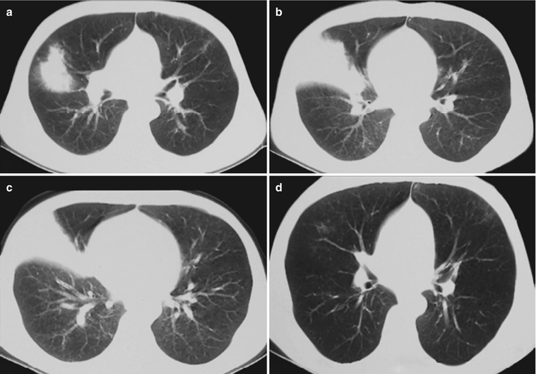 Fig.17.49