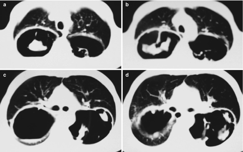 Fig. 17.70