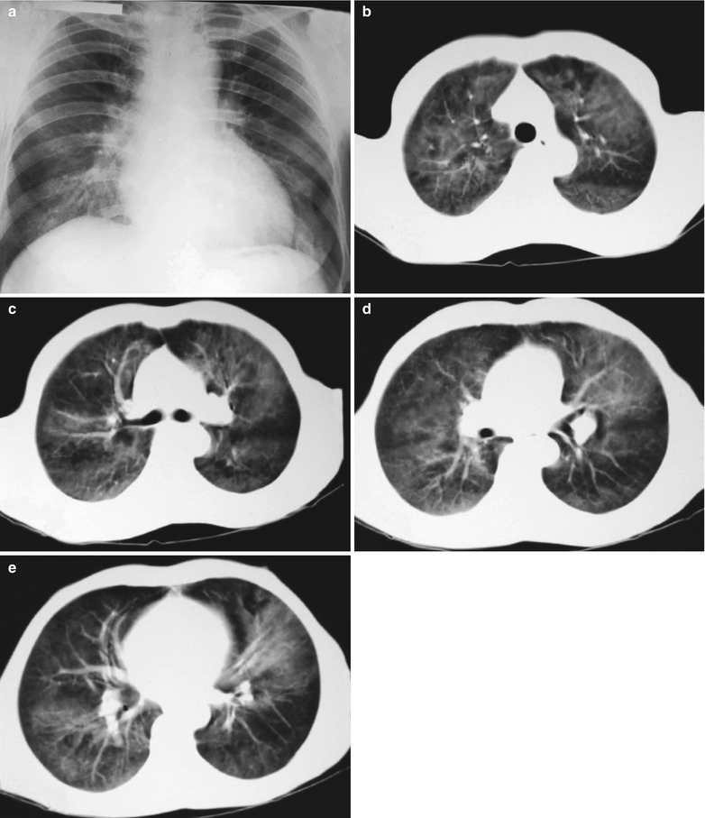 Fig. 17.4