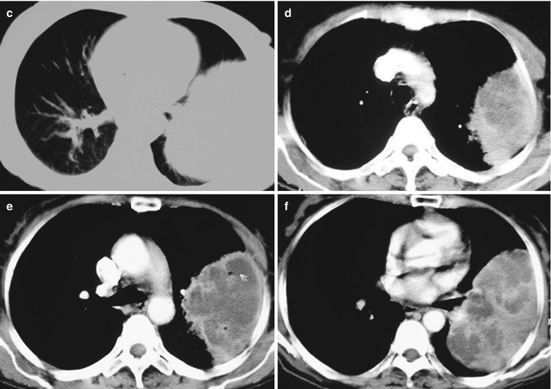 Fig. 17.46