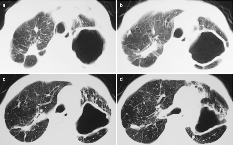 Fig. 17.39