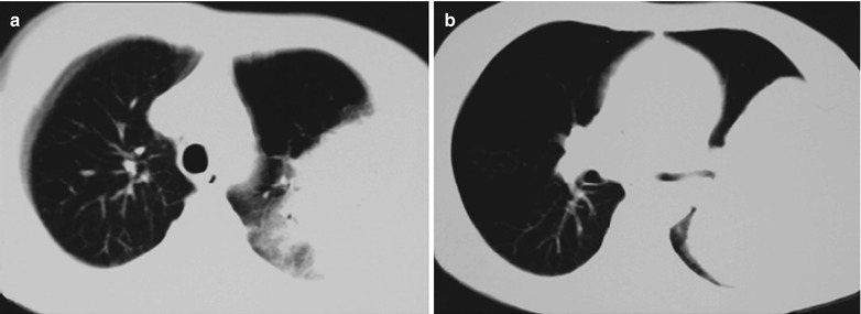 Fig. 17.46