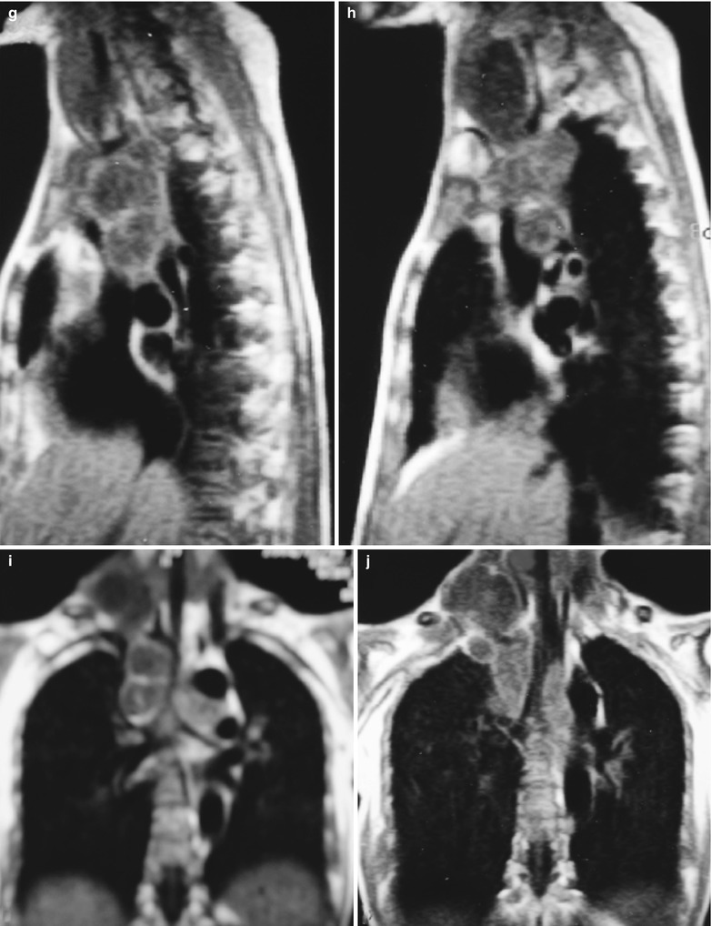 Fig. 17.25