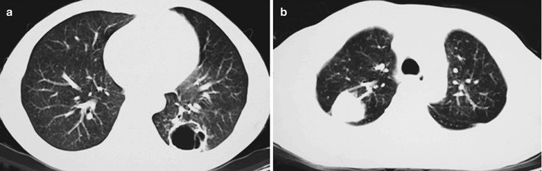 Fig. 17.84