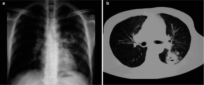 Fig. 17.85