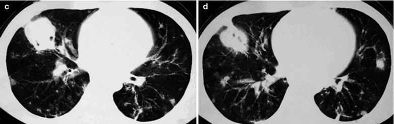 Fig. 17.92