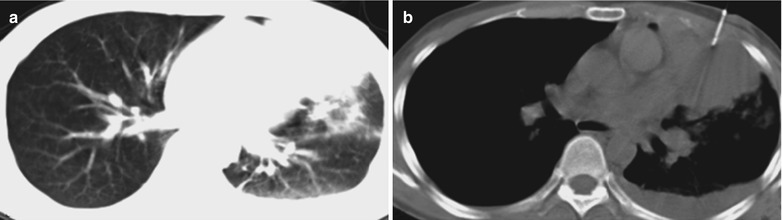 Fig. 17.36