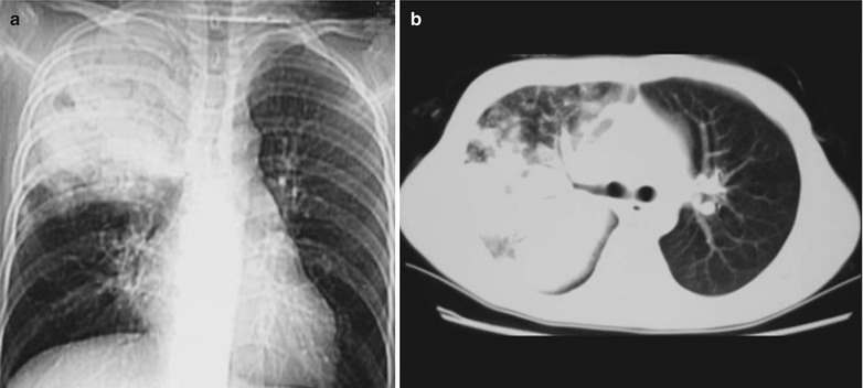 Fig. 17.35