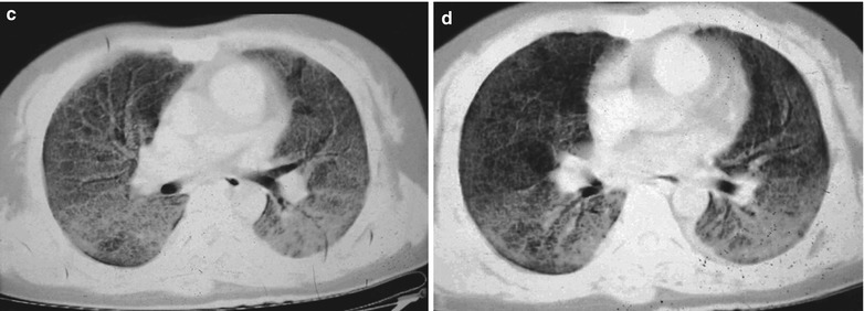 Fig. 17.7