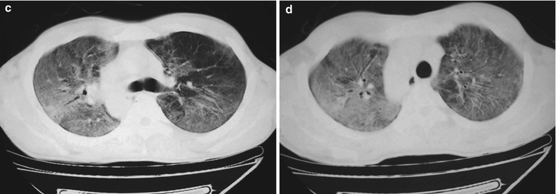 Fig. 17.6