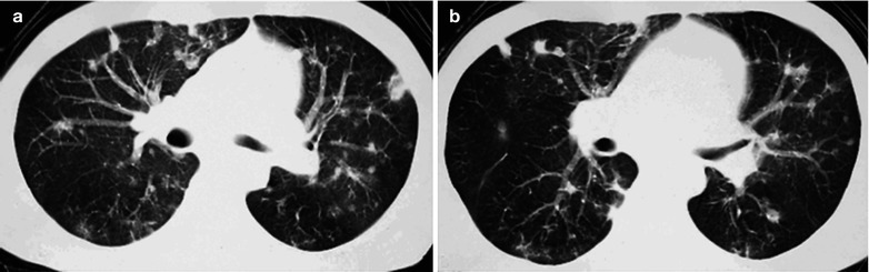 Fig. 17.92