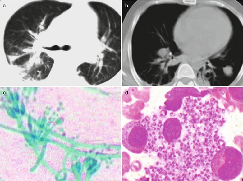 Fig. 17.95