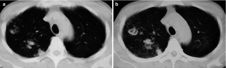 Fig. 17.94