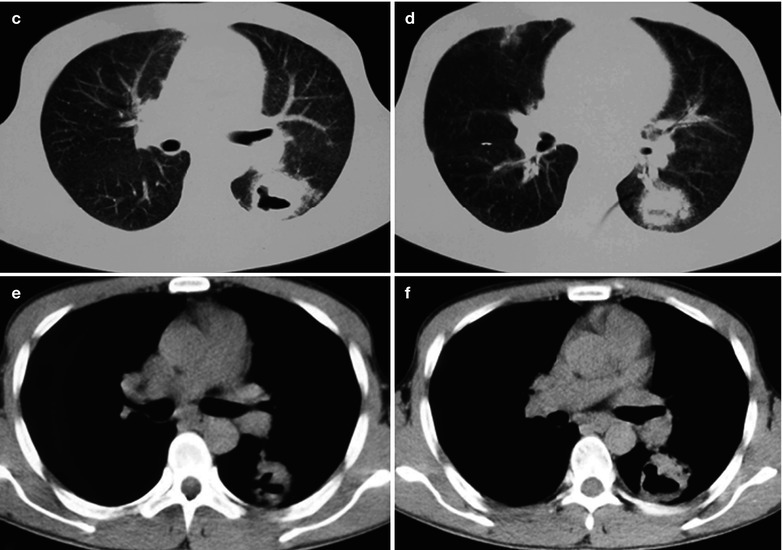 Fig. 17.85