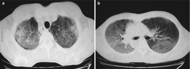 Fig. 17.6