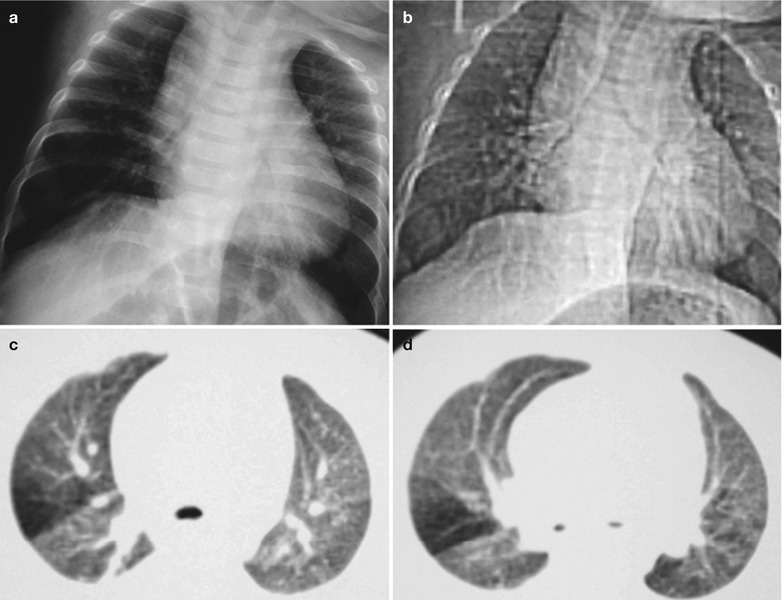 Fig. 17.98