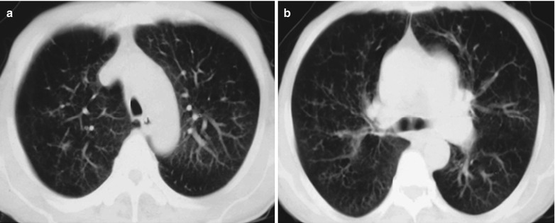 Fig. 17.105