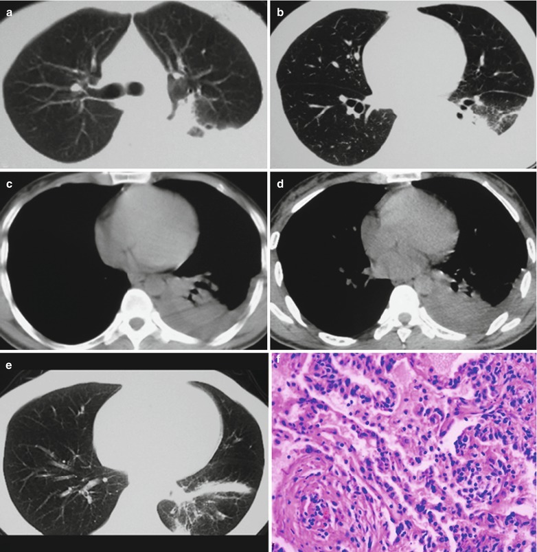 Fig.17.58