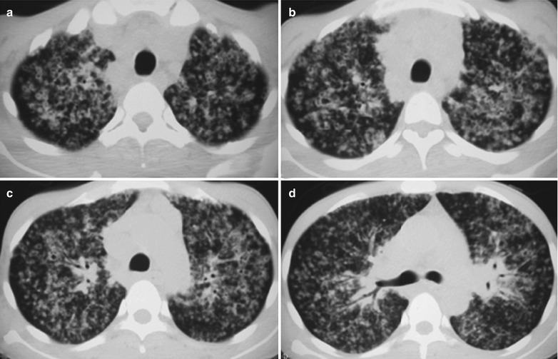 Fig. 17.32