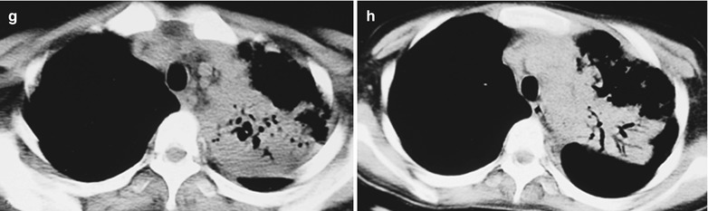 Fig. 17.106