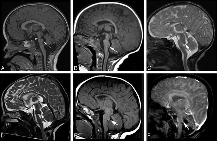 Fig 1.