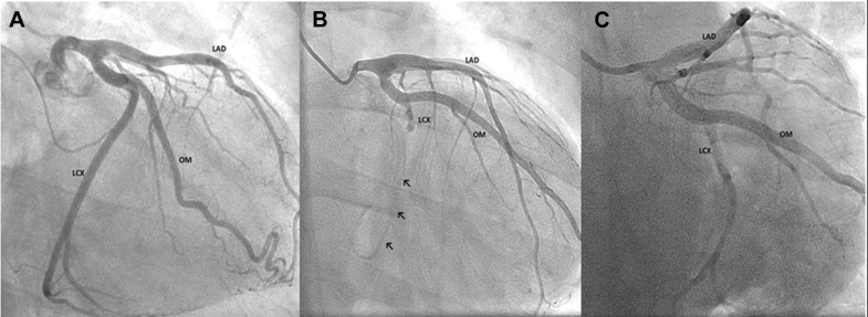 Figure 1