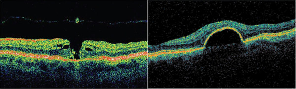 Figure 15