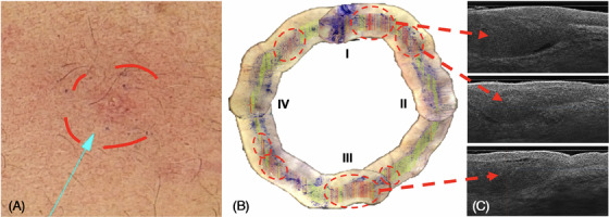 FIGURE 2