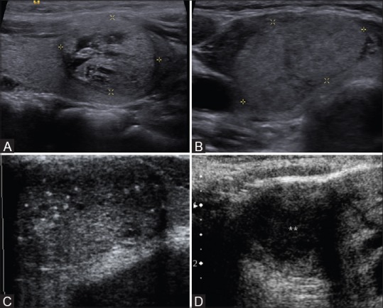 Figure 2 (A-D)