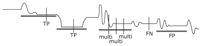 Fig. 11