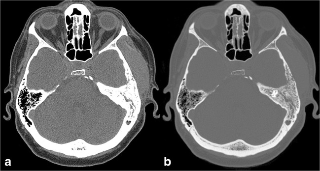 Fig. 11