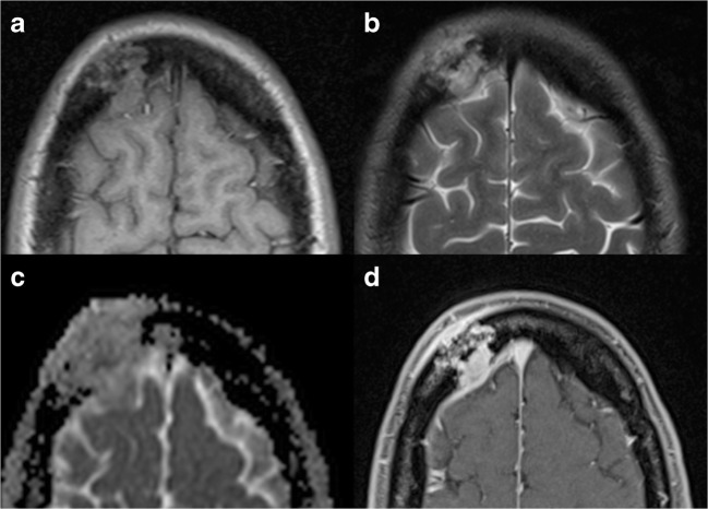 Fig. 10