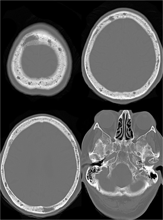 Fig. 13