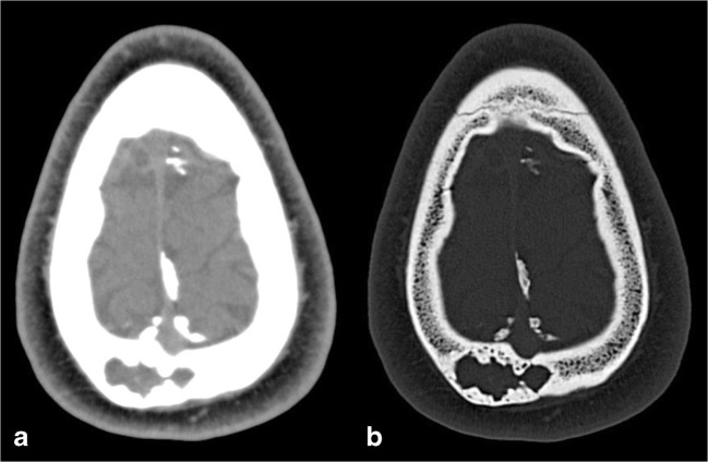 Fig. 7