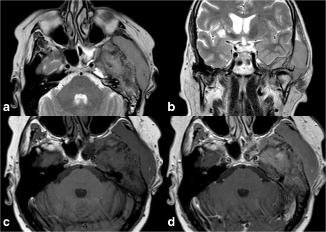 Fig. 12