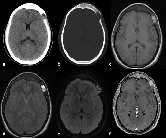 Fig. 6