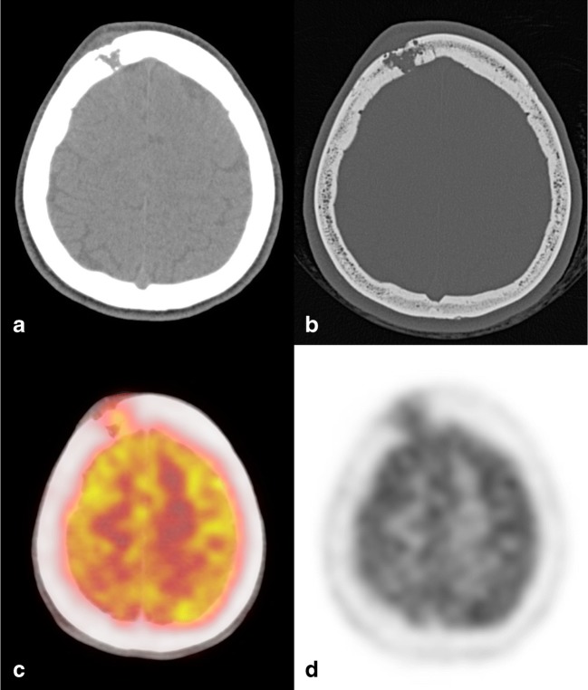 Fig. 9