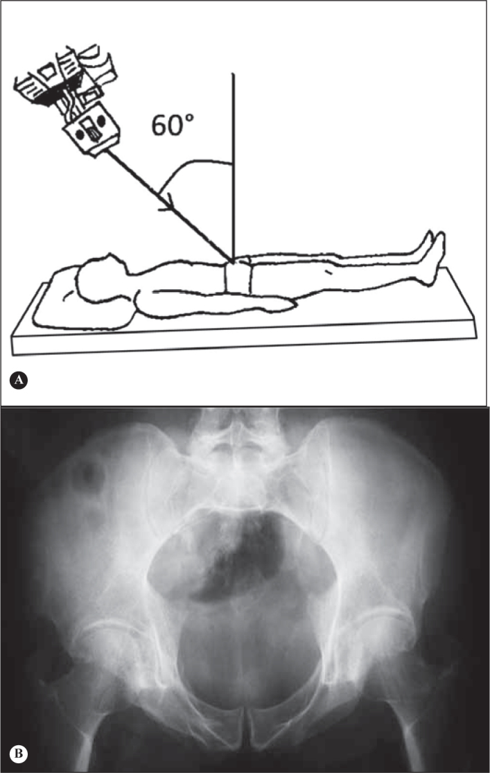 Figure 16