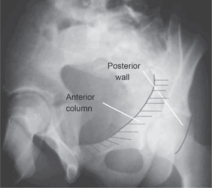 Figure 15