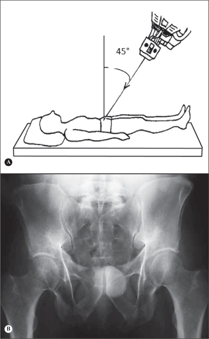 Figure 17