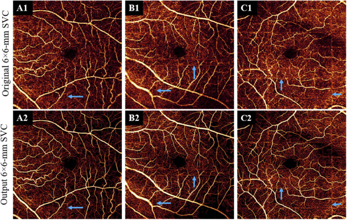 Fig. 11.