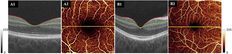 Fig. 1.