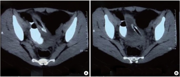 Fig. 5.