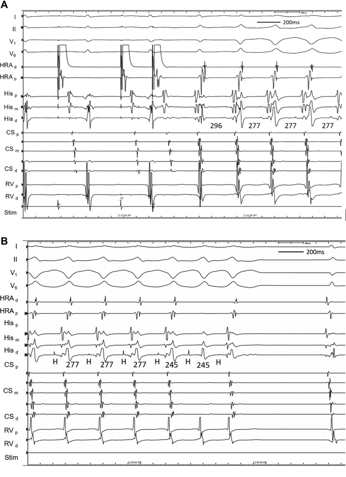 Figure 1