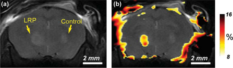 Fig. 10