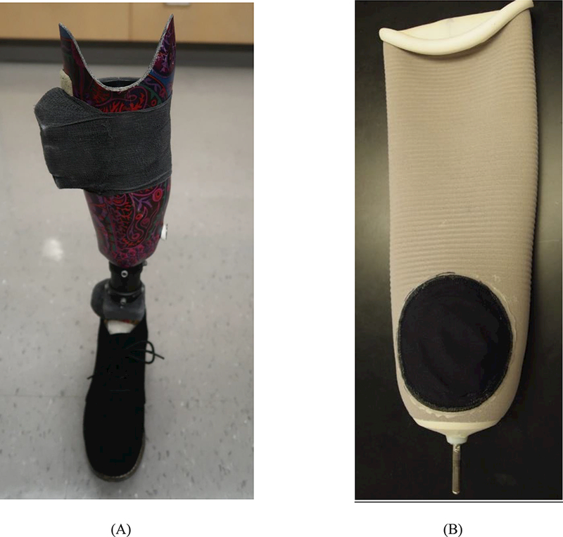 FIGURE 1A,B.